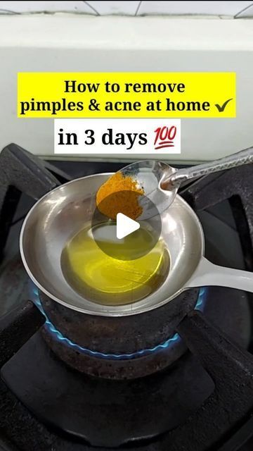 Generated Description with relevant hashtags. How To Pimple Remove, How To Remove Pimples In One Day, Skin Care For Pimples And Acne, Pimples Marks Removal, Pimple Remove Tips At Home, How To Get Rid Of Pimples Overnight Fast Clear Skin, Natural Pimple Remedy Overnight, How To Remove Pimples At Home, How To Remove Acne