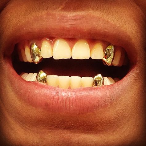 Silver canine teeth Gold Teeth Men, Permanent Gold Teeth, Gold Tooth Cap, Dental Impression Material, Mouth Grills, Bottom Grill, Girl Grillz, Canine Teeth, Grillz Teeth