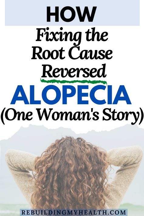 Shampoo For Alopecia, Hairstyles For Alopecia For Women, Traction Alopecia Regrowth, Androgenic Alopecia In Women, Alopecia Diet, Hairstyles For Alopecia, Scarring Alopecia, Alopecia Hair Growth, Endo Diet