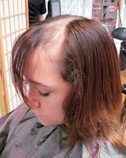 Medium Hair Ideas, Hair Styles For Medium Hair, Styles For Medium Hair, Hair Extensions For Short Hair, Hair Replacement Systems, Hair System, Hair Help, Lost Hair, Hair Solutions