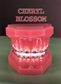 Red Braces Teeth, Red Braces Color, Teeth Gens, Brace Colors, Power Chain Braces, Dental Braces Colors, Braces Colors Combinations, Tongue Web Piercing, Braces Ideas