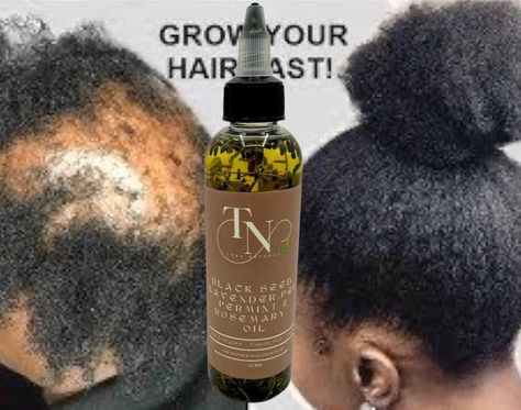 Kalonjiseed Hair Growth Oil Herbal Extracts Hair Oil Blackseed Hair Growth Oil natural Infused Oil for Hair hair Oil Hair Growth Oil - Etsy UK Rosemary Hair Growth, Natural Hair Growth Oil, Natural Hair Oils, Black Seed Oil, Herbal Oil, Herbal Extracts, Growth Oil, Black Seed, Infused Oils