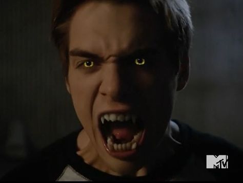 Teen Wolf Season 5, Teen Wolf Werewolf, Punched In The Face, Boyfriend Quiz, Liam Dunbar, Teen Wolf Scott, Teen Wolf Seasons, Dylan Sprayberry, Teen Wolf Mtv