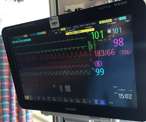 Hospital Heart Monitor, Hospital Monitor, Barbie Hospital, Hospital Core, Ecg Interpretation, Patient Monitor, Hospital Photography, Heart Monitor, Medical School Motivation