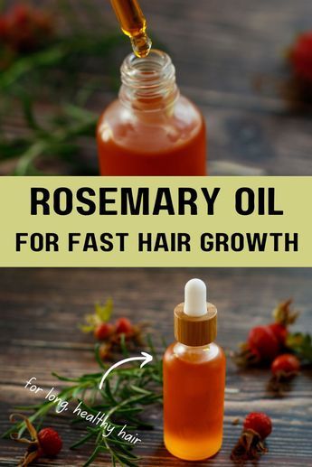 Boost hair growth and prevent hair loss with this DIY Rosemary and Rosehip Oil for hair! It’s easy to make at home, just needs 2 ingredients and only a couple of minutes of your time. Address common hair concerns by adding this homemade hair oil to your natural hair care routine. Nourish your precious mane from the roots to the tips, and simultaneously, you take care of your scalp health (especially if you have a dry scalp). Rosehip promotes hair thickness, faster hair growth, healthy hair, shiny hair. Homemade oil with either fresh or dried rosemary, or rosemary essential oil. Homemade Hair Care DIY recipes Homemade Rosemary Hair Oil, Diy Rosemary Oil For Hair, Rosemary Oil For Hair Growth Diy, Homemade Hair Oil For Growth, Diy Rosemary Oil, Rosehip Oil For Hair, Homemade Hair Care, Homemade Hair Oil, Hair Oil Recipe