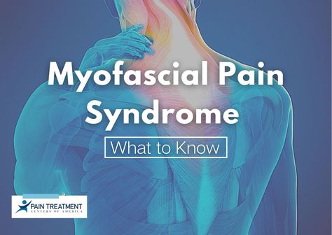 For people with myofascial pain syndrome, pain can become a regular part of their life. While it’s not certain exactly what causes it, one thing is for sure—people need relief. Medical Symptoms, Myofascial Pain Syndrome, Referred Pain, Pain Relief Remedies, Dry Needling, Complex Regional Pain Syndrome, Shoulder Pain Relief, Musculoskeletal System, Myofascial Release