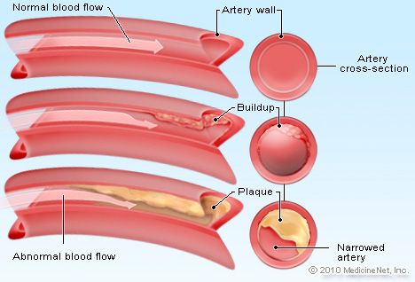 What Is Cholesterol, Cholesterol Test, Homeopathy Medicine, Cholesterol Medications, Cholesterol Remedies, Cholesterol Lowering Foods, Hdl Cholesterol, Cholesterol Diet, Ldl Cholesterol