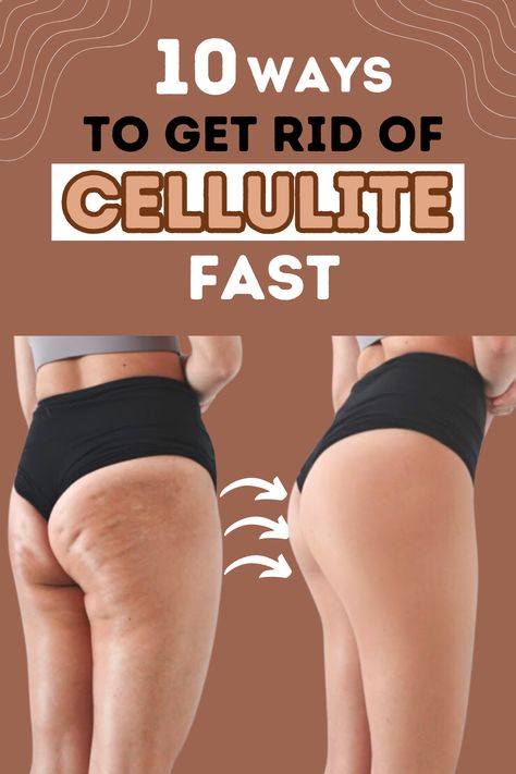 Get Rid Of Thigh Fat Fast, How To Get Rid Of Leg Cellilute, Workouts To Get Rid Of Cellilute Fast, Get Rid Of Cellilute Disease, How To Get Rid Of Strech Marks On Thighs, How To Get Rid Of Cellilute Fast Diy, How To Get Rid Of Cellilute Fast, How To Get Rid Of Cellilute Fast Workout, How To Get Rid Of Back Fat Fast