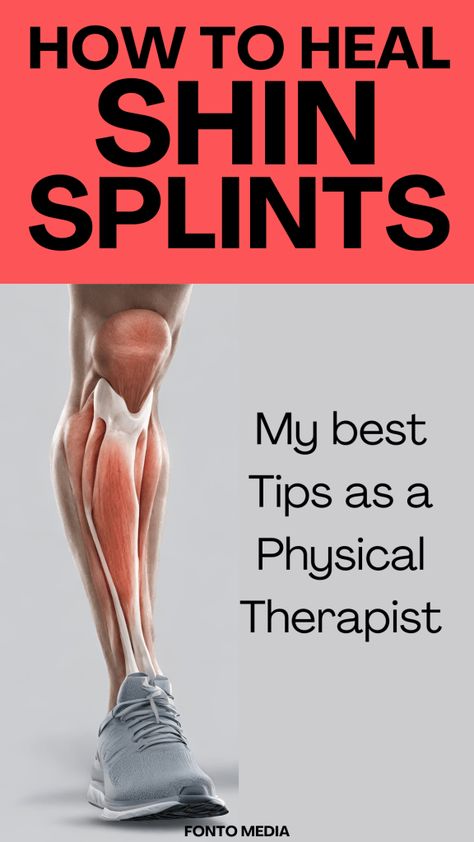 shin splints, tibia fracture, stress fracture, exercice, physical therapy Chin Splints Remedy, Kt Tape Shin Splints, Shin Splints Taping, Anterior Shin Splints, Shin Splints Stretches, Shin Splint Relief, Shin Splint Exercises, K Tape, Music Prints