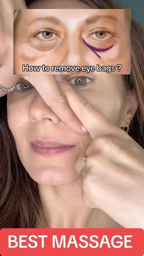 VIOLA | 🌟 SAY GOODBYE TO UNDER-EYE BAGS WITH THE BEST MASSAGE TECHNIQUES! 🌟 Tired of waking up with puffy eyes? ✨ Check out my reel for the… | Instagram Face Lift Exercises, Baggy Eyes, Face Workout, Facial Exercise, Face Massage Techniques, Wrinkles Remedies, Massage Routine, Eye Massage, Massage Face