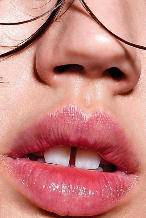 Mouth Photography, Richard Burbridge, Lindsey Wixson, Gap Teeth, Face Drawing Reference, Nose Shapes, Human Reference, Face Reference, Hot Lips