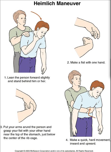 Heimlich maneuver - for adults, children, infants, pregnant women, yourself & your pets | GODYEARS Heimlich Maneuver, First Aid Cpr, Medical Life, First Aid Tips, Emergency First Aid, Survival Life Hacks, Survival Life, Disaster Preparedness, Girls Camp