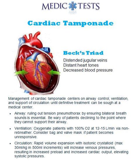 Respiratory Therapy Notes, Cardiac Tamponade, Telemetry Nursing, Medical Math, Emt Study, Cardiac Sonography, Nurse Teaching, Paramedic School, Nurse Study