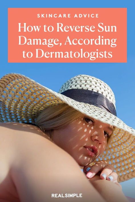 Sun Damage On Face, Sun Spots Removal, Repair Sun Damaged Skin, Damaged Skin Repair, Face Peel, Chemical Peels, Best Lotion, Sun Damaged Skin, Chemical Peel