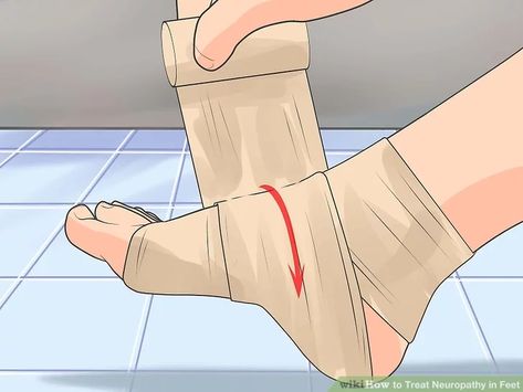 How to Treat Neuropathy in Feet: 15 Steps (with Pictures) Nerve Pain Remedies, The Peripheral, Peripheral Nervous System, Nerve Health, Foot Pain Relief, Nerve Pain Relief, Nerve Damage, Leg Pain, Hip Pain