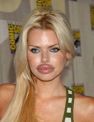 there are no words... and she probably couldn't say them if they were...Bet she wishes she did not have that lip enhancement surgery! Lip Plastic Surgery, Bad Plastic Surgeries, Plastic Surgery Fail, Plastic Surgery Gone Wrong, Lip Augmentation, Celebrity Plastic Surgery, Duck Face, Lip Injections, Estilo Punk