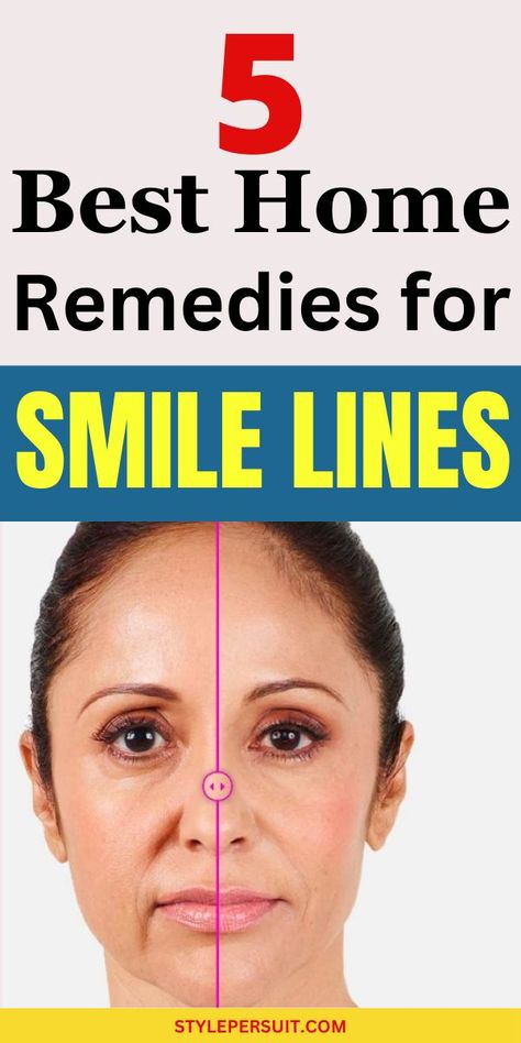 Smile lines, also known as laugh lines or nasolabial folds, are the creases that form around the mouth and nose as a natural part of aging. While they're a testament to a life filled with joy and laughter, some people may feel self-conscious about them and seek ways to minimize their appearance. While completely getting rid of smile lines may not be possible, there are several strategies to reduce their prominence and keep your skin looking youthful and vibrant. Lines Around Mouth, Laugh Lines, Get Glowing Skin, Dark Underarms, Smile Lines, Nasolabial Folds, Anti Aging Eye Cream, Luxury Cosmetics, Diy Hair Care