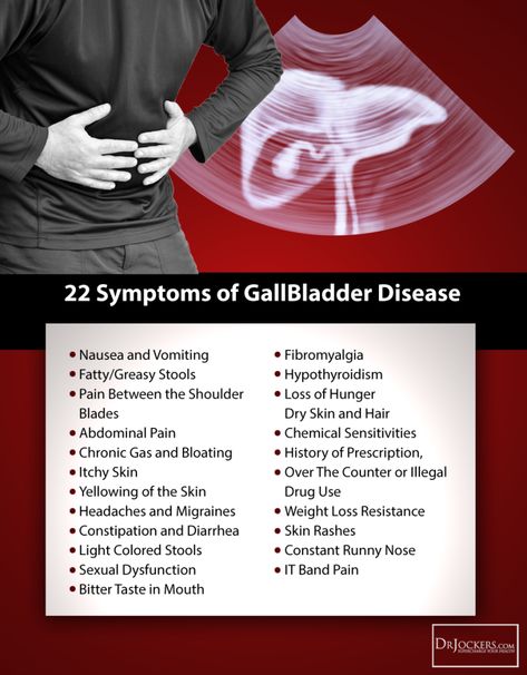 22SymptomsofGallbladderDiseasePic Gallbladder Symptoms, Gallbladder Attack, Gallbladder Diet, Gall Bladder, Detox Your Liver, Detox Diet Plan, Liver Detox, Healthy Liver, Natural Therapy