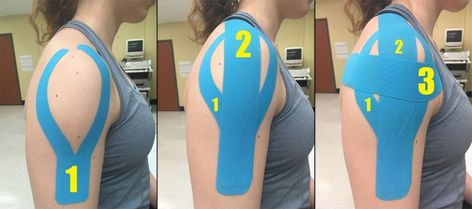 Rotator Cuff Injury Exercises, Rotator Cuff Rehab, Rotator Cuff Pain, Shoulder Rehab Exercises, Rotator Cuff Exercises, Rotator Cuff Surgery, K Tape, Shoulder Rehab, Rotator Cuff Tear