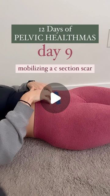 Dr. Courtney | Pelvic Floor Physical Therapist & Coach on Instagram: "On day 9 of the 12 days of Christmas your pelvic health bestie is hear to teach you about C section scar MOBILITY!  Empowering C-section moms to care for their C-section scar and abdominals is incredibly important because it can make a HUGE difference in your function AND your emotional stability !☺️  As C sections are MAJOR abdominal surgeries (and are often sent home with little information on how to heal) we are sharing a few ways you can work on your C-section scar and abdomen to get things moooving and grooving again (and prevent that c section shelf🙅🏼‍♀️)  ➡️ Work on your abdominals ABOVE and BELOW your scar as well as directly on it.  ➡️ Work on your scar while moving your pelvis and ribcage. Our scar moves duri C Section Shelf, Pelvic Floor Challenge, 4 Weeks Postpartum, Healing From C Section, Full Body Mobility, Scar Massage, C Section Scar, C Section Scars, C Section Recovery