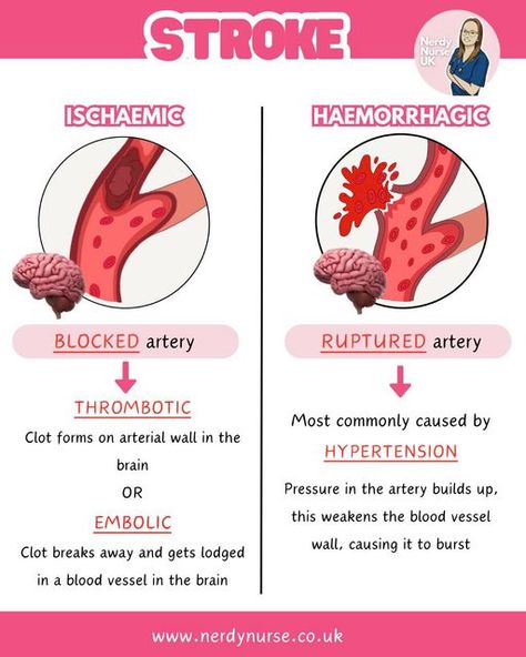 Lauren - Nursing made easy on Instagram: "Ischaemic vs haemorrhagic stroke  A very simple overview  #nursingclinicals #pathophysiologyclass #pathophysiologynotes #nursingstudentsofinstagram #studentnursestudytips #nursingstudentnotes #studentnurses #futurenurses #nursingresources #nurseintraining #nurseinprogress #adultnursing #nursetobe #nursingassociates #traineenursingassociates #traineenursingassociate #studentparamedicuk #studentparamedicsuk #studynursing #studentnurseuk #studentnurse #nursingnotes #nursingschool #nursingstudent #studentnursesofinstagram #studentparamedic #pathophysiology" Gi Nursing, Med Surge, Pathophysiology Nursing, What Is Intelligence, Nurse Study, Ulnar Nerve, Nursing School Essential, Nursing School Motivation, Student Tips