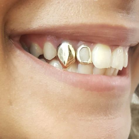 Single Grillz! Some of our most popular and famous grillz belong here. Worn by the likes of Rita Ora, Jorja Smith, Alex Iwobi and many more. All orders include mould kit with two tries, jewelry polishing cloth and grillz case. Single Grillz are designed to cover individual teeth. Gold Tooth Cap, Mouth Grills, Dental Jewelry, Grillz Teeth, Teeth Caps, Gold Grillz, Grills Teeth, Tooth Gem, Teeth Jewelry