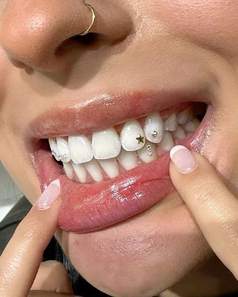 Tyla Artist Tooth Gem, Star Tooth Gems Ideas, Tooth Gems Star, Basic Tooth Gem Ideas, Gold Tooth Gem, Tooth Gems Black Women, Gems On Teeth, Simple Tooth Gems Ideas, Simple Tooth Gems