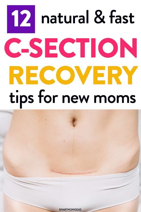 Postpartum tips to help with your csection recovery plan. Learn 12 natural and fast c-section recovery tips to help speed the healing during your first week home as a new mom. #postpartum #givingbirth #csection C Section Recovery Timeline, Postpartum Must Haves, Postpartum Care Kit, C Section Recovery, Cesarean Section, Body After Baby, Postpartum Belly, Postpartum Body, Baby Sleep Problems