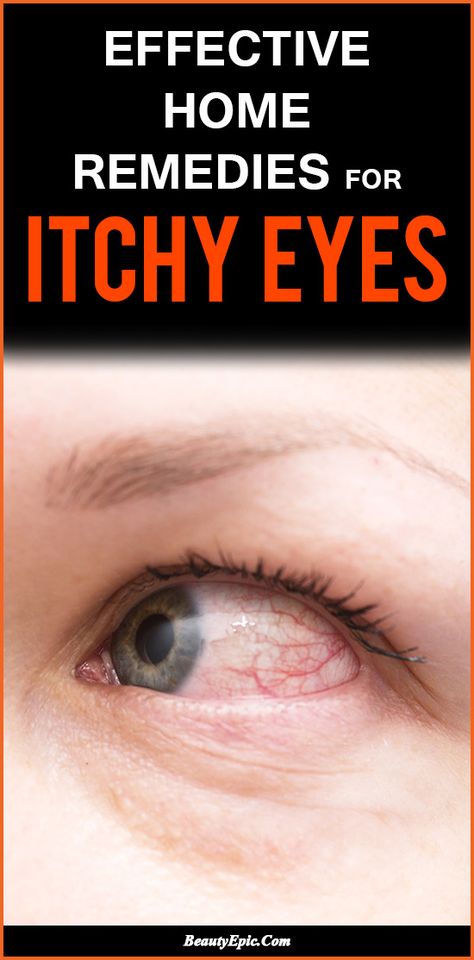 7 Quick Home Remedies For Itchy Eyes That Start Working Right Now Natural Remedies For Stye Eye, Remedies For Itchy Eyes, Itchy Nose Remedy Allergies, Dry Eyes Remedy Natural Treatments, Vertigo Remedies, What Causes High Cholesterol, Home Remedies For Allergies, Natural Remedies For Migraines, Itchy Eyes