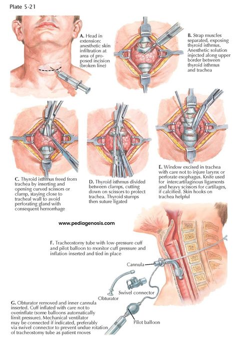 Medical Diagrams, Jeans With Holes, Studera Motivation, Jeans Korean, Medical School Life, Basic Anatomy And Physiology, Mid Rise Pants, Nurse Study Notes, Medical Student Motivation