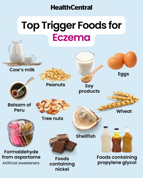 Health Chart, Peanut Allergy, Nickel Allergy, Soy Products, Nutrient Rich Foods, Gut Healing, Fatty Fish, Foods To Avoid, Artificial Sweetener