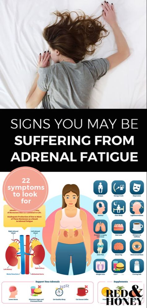 Adrenal Fatigue Symptoms Signs, Low Thyroid Remedies, Thyroid Remedies, Adrenal Fatigue Symptoms, Fatigue Symptoms, Low Estrogen Symptoms, Adrenal Health, Too Much Estrogen, Estrogen Dominance