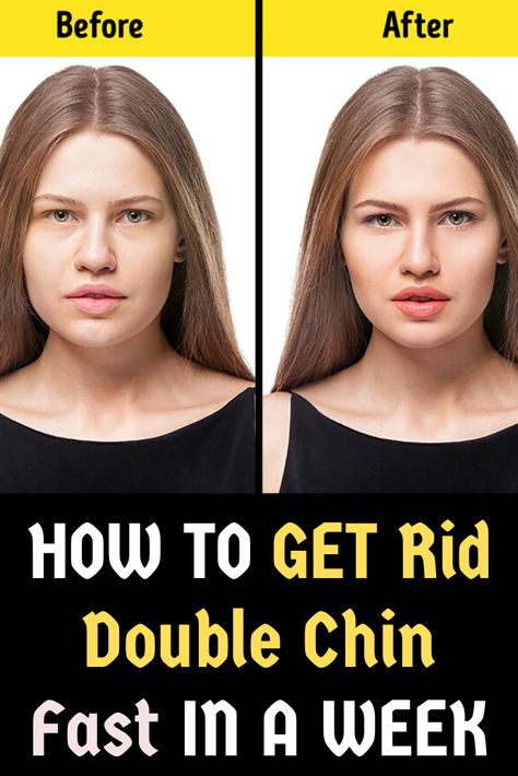 Cheek Fat, Rid Of Double Chin, Reduce Face Fat, Jawline Exercise, Exercise While Pregnant, Face Fat Loss, Double Chin Exercises, Reduce Double Chin, Chin Exercises