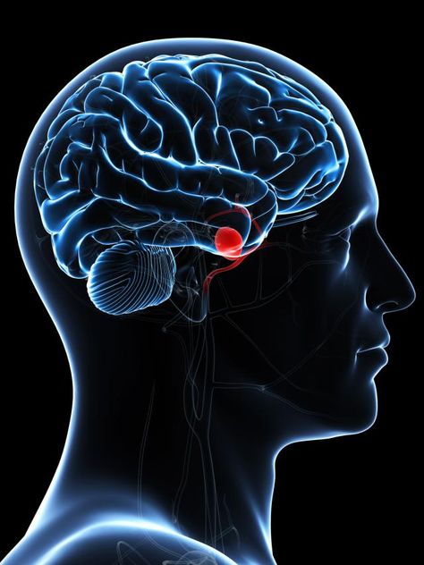 What to expect from a brain aneurysm. Learn more about what an aneurysm is and the prognosis of a brain aneurysm. Throbbing Headache, Foot Reflexology Massage, Brain Surgeon, Congenital Heart, Reflexology Massage, Foot Reflexology, Brain Surgery, Migraine Headaches, Soft Glam