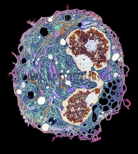 White blood cell. Coloured transmission electron micrograph (TEM) of a section through a white blood cell. White blood cells are part of the body's immune system. There are seven common types of white blood cell, but they all form from the same type of stem cell and all have some specific function in defending the body against disease and foreign objects. Here, the nucleus (right) is bi-lobed, a characteristic of a type of white blood cell known as an eosinophil. The other white blood cell type Van Gogh Wallpaper, White Blood Cell, What Is Stem, Microscopic Photography, Cord Blood Banking, Microscopic Images, Biology Art, Electron Microscope, White Blood