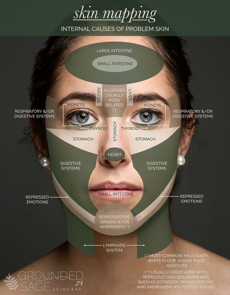 Acne Zones Face Mapping, Pimple On Face Reason, Location Of Pimples Meaning, Face Organ Map, Spot Face Map, Why Do I Get Pimples On My Chin, Spot Mapping Face, Breaking Out On Cheeks, Acne Location Meaning Face Mapping