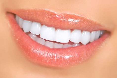 Affirmation: My teeth are straight, pearly white, strong, clean & healthy. Whiten Whites, Teeth Whitening Remedies, Pasta Dental, Yellow Teeth, Teeth Whitening Strips, Best Teeth Whitening, Natural Teeth Whitening, Natural Teeth, Cosmetic Dentistry