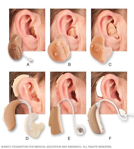 Swimmers Ear Remedy, Throat Anatomy, Audiology Student, Swimmers Ear, Portugal Art, Auditory Processing Disorder, Speech And Hearing, Auditory Processing, Hearing Health