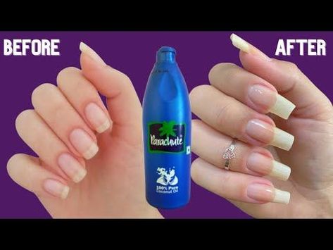 How To Grow Nails Faster Nail Growth Tips Faster, How To Whiten Nails, Grow Your Nails Faster, Cute Nails Black, Gel Nail Art Ideas, White Spots On Nails, Make Nails Grow, Nail Tricks, Fast Drying Nail Polish