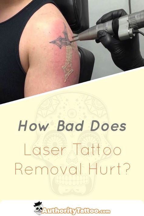 You may want to get a tattoo removed but you're worried about how much the process might hurt. We reveal all about laser tattoo removal pain in this article. Make Temporary Tattoo, Tattoo Removal Cost, Bolt Tattoo, Full Leg Tattoos, Full Tattoo, Cloud Tattoo, Healing Tattoo, Tattoo Care, Bad Tattoos