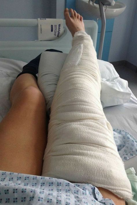 Bandage Leg In Hospital, Leg Bandage Snapchat, Broke Leg Snapchat, Broken Knee, Spiegel Selfie, Iphone Screen Repair, Plant Styling, Wheelchair Women, Leg Cast