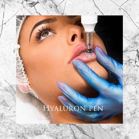 Hyaluron Pen Lip Filler, Makeup Business Names, Hyaluronic Pen, Skin Tightening Procedures, Hyaluronic Acid Lips, Hyaluronic Acid Fillers, Bb Glow, Esthetician Marketing, Cross Tattoos For Women