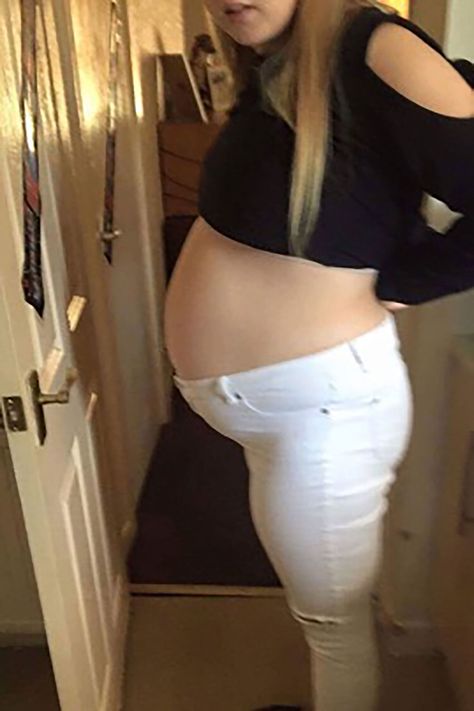 Woman Thought She Was 8 Months Pregnant, Discovers She Actually Had a Giant Cyst 8 Weeks Pregnant, 11 Weeks Pregnant, 8 Months Pregnant, Weeks Pregnant, Pregnancy Week By Week, 8 Months, Pregnant Women, White Jeans, Health