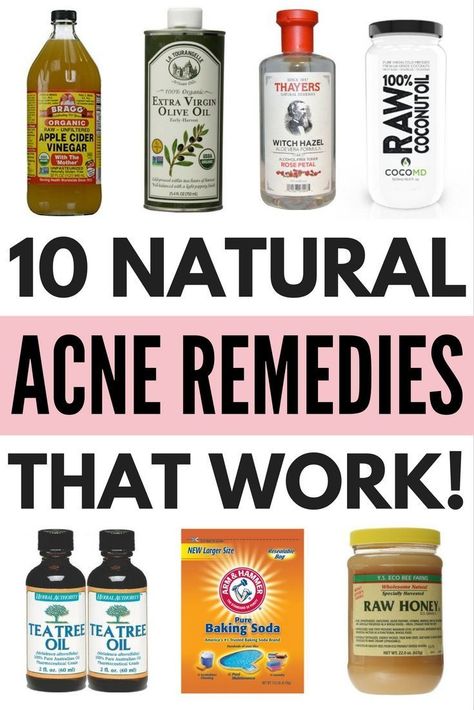 Honey Baking, Coconut Oil For Acne, Skin Care Routine For 20s, Diy Acne, Natural Acne Remedies, Get Rid Of Acne, Natural Acne, Home Remedies For Acne, Coconut Oil Uses