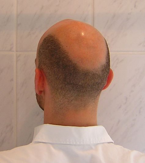 Bald Bearded Tattooed Men, Male Pattern Baldness Hairstyles, Horseshoe Haircut, Bald Head Man, Bald People, Shave Your Head, Bald Guy, Red Hair Men, Handsome Bearded Men