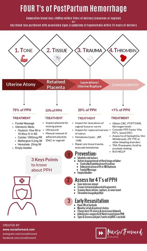 PPH_fourTs_nurse_forward_infographic_final Post Partum Hemorrhage, Obstetrics Nursing, Postpartum Hemorrhage, Newborn Nursing, Midwifery Student, Postpartum Nursing, Labor Nurse, Nursing Mnemonics, Neonatal Nurse