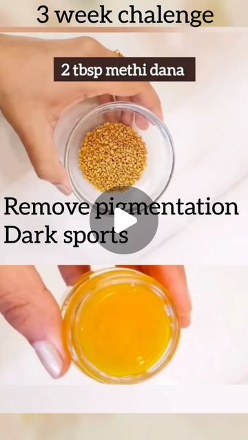 Dark Pigmentation Remedies, Remedies For Pigmentation On Face, Body Pigmentation Products, How To Remove Pigmentation, How To Remove Pigmentation On Face, Face Pigmentation Remedies, Face Glowing Tips Natural, Dark Skin Around Neck, Pigmentation On Face