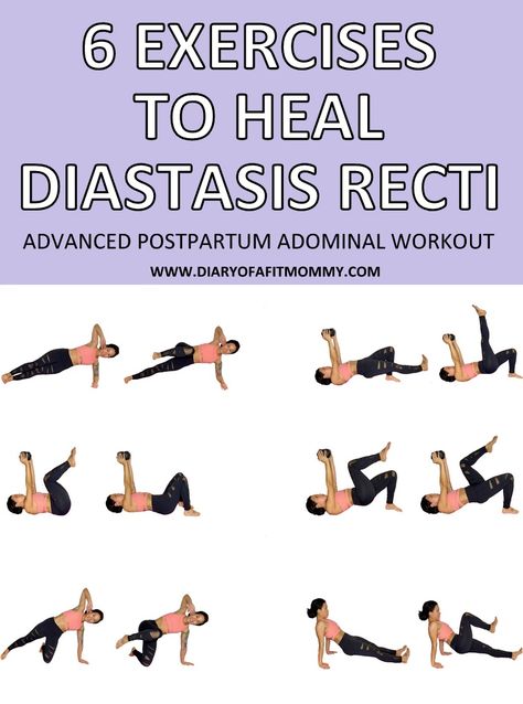 6 Exercises to Fix & Heal Diastasis Recti | ADVANCED Postpartum Abdominal Repair Workout - Diary of a Fit Mommy Exercises For Abdominal Separation, Oblique Exercises For Diastasis Recti, Abdominal Separation Diastasis Recti, Ab Separation Diastasis Recti Exercise, Diastasis Recti Wall Exercises, Abdominal Diastasis Recti Ab Exercises, Ab Exercises For Diastasis Recti, Ab Separation Diastasis Recti, Abdominal Separation Exercises