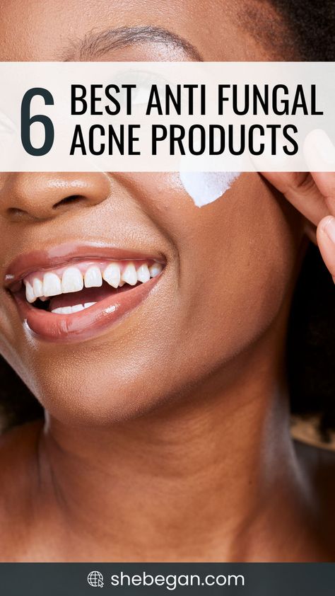 If you’re struggling with acne that just doesn’t seem to go away, it might not be your typical acne, it could be fungal acne. This type of acne is a bit different and needs special care.  But the good part is that, once correctly identified, fungal acne can be effectively managed with the right products. Whether you’re just curious or seriously seeking a solution, this article aims to provide you with valuable information on the 6 best anti fungal acne products. How To Clear Fungal Acne, Fungle Acne, Fungal Acne Skin Care Routine, Hard Pimple, Cetaphil Acne, Acne Prone Skin Care Routine, Acne Safe Makeup, Painful Acne, Safe Makeup