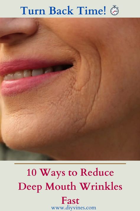 10 Ways to Reduce Deep Mouth Wrinkles Fast Deep Wrinkles Around Mouth, How To Get Rid Of Smile Lines Mouths, How To Get Rid Of Frown Lines By Mouth, How To Get Rid Of Laugh Lines, How To Get Rid Of Wrinkles, Frown Lines Around Mouth, Wrinkles Around Mouth, Lines Around Mouth, Cheek Wrinkles